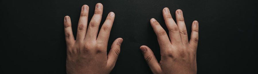 Worried about side effects of arthritis medications? Your DNA is the key to long-term safety of treatment